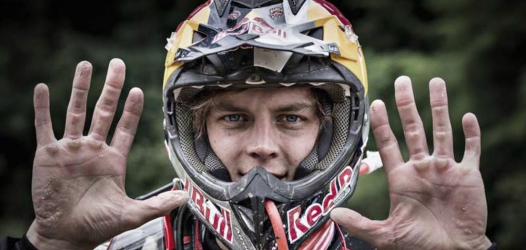 Gimme 10: Surprisingly painful minor riding injuries S7